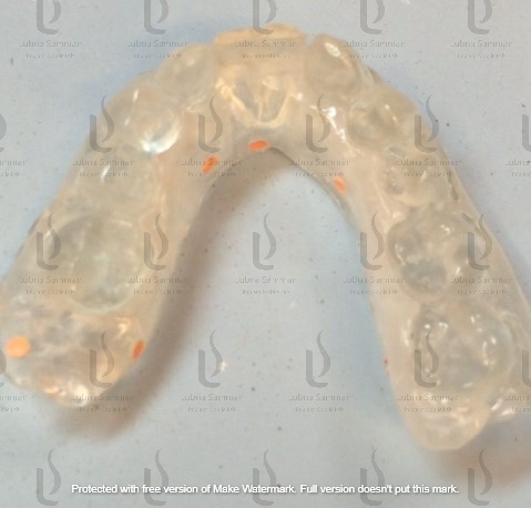 2 PC Radiographic stent