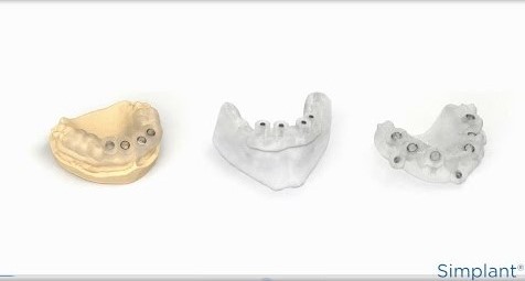 Simplant